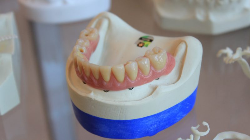 implantologia, dentysta