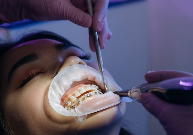 awaria aparatu ortodontycznego