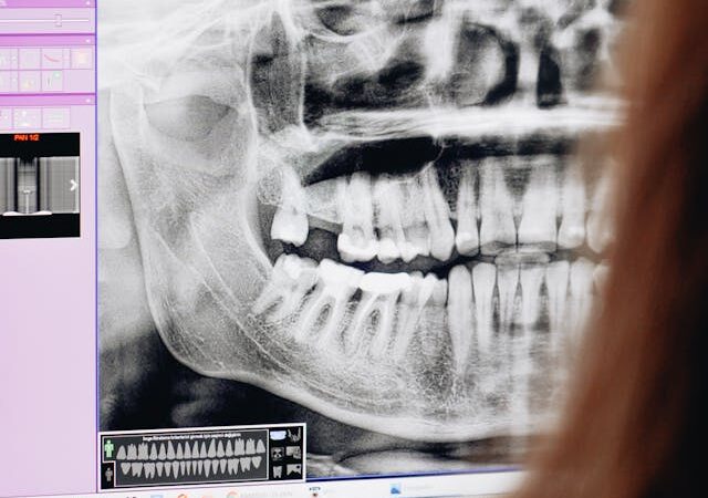 Bezpieczeństwo RTG zębów