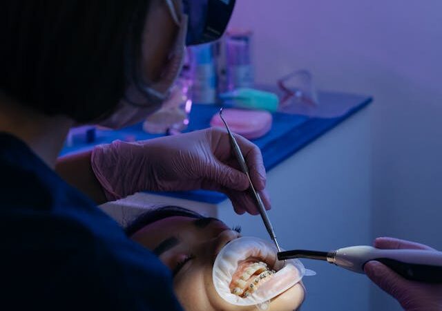 Jak się zakłada aparat na zęby