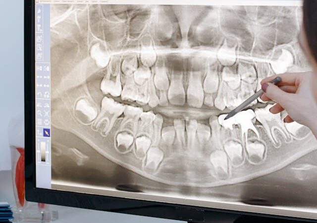 Jak długo ważne jest RTG zębów?