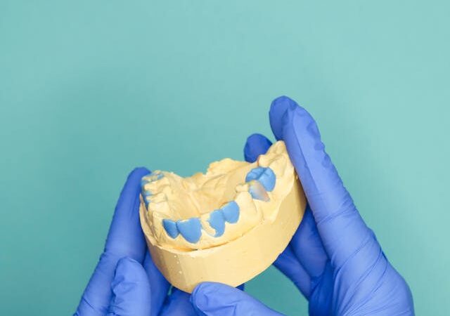 Czy irygator jest konieczny przy moście All on X?