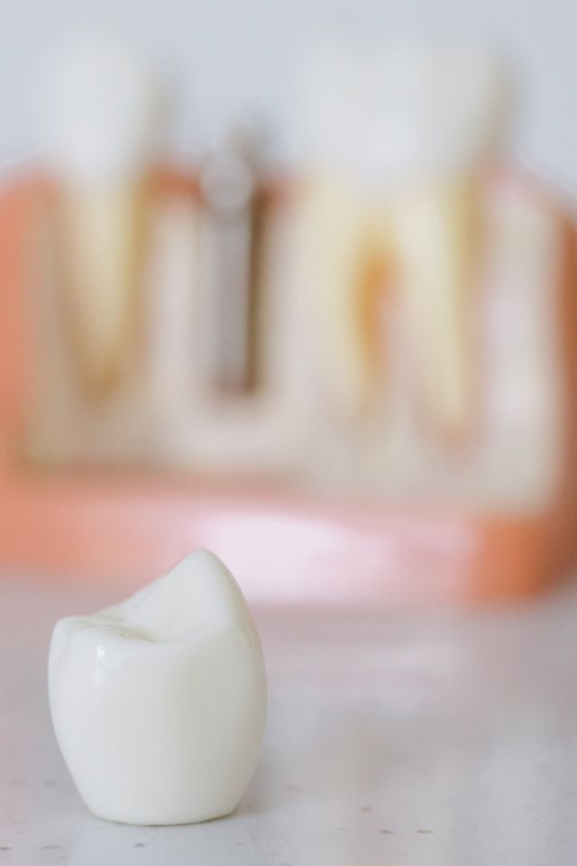 Kiedy natychmiastowy implant po wyrwaniu zęba nie jest możliwy?