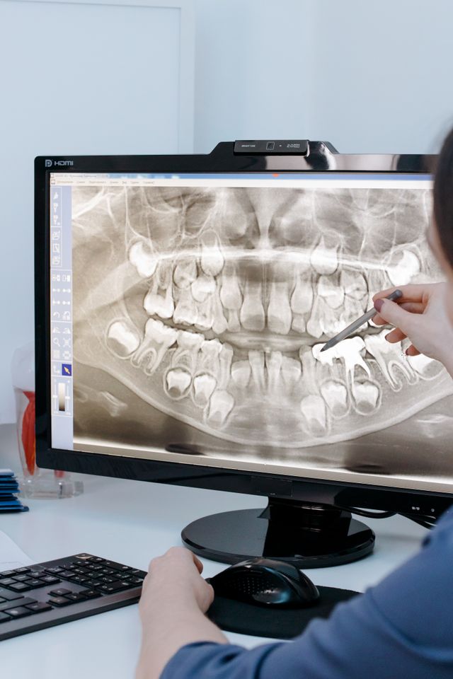 Kiedy po RTG zęba dentysta może zlecić tomografię?